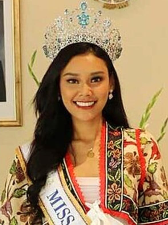 Miss Supranational 2024 Harastha Haifa Zahra Kunjungi Permata dan YDTI