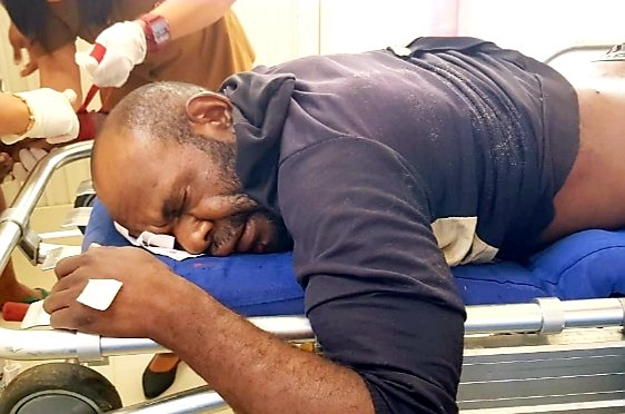 Yulius Wetipo, Korban Penembakan Brutal KKSB di Nduga Meninggal Dunia di RS Charitas Timika