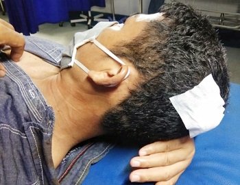Amankan Demo di Sumut, Puluhan Polisi Terluka Akibat Terkena Lemparan Batu